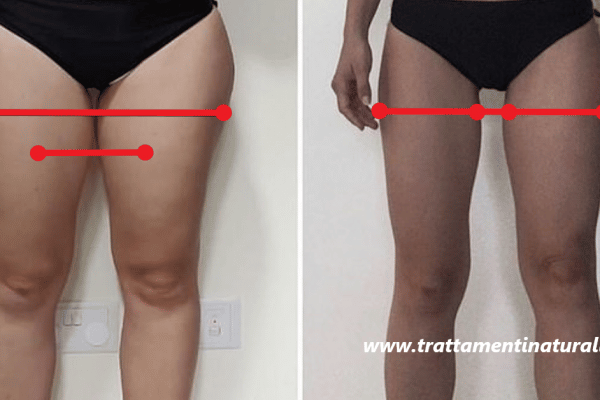 Comment puis-je perdre de la graisse de cuisse ?